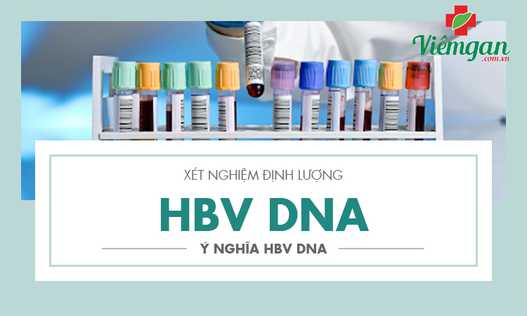 Xét nghiệm định lượng HBV-DNA là gì? Ý nghĩa định lượng HBV DNA