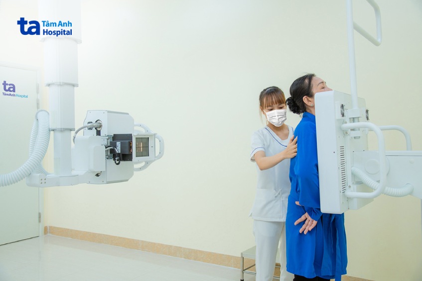 Chup X-quang ngực giúp xác định nguyên nhân tức ngực khó thở