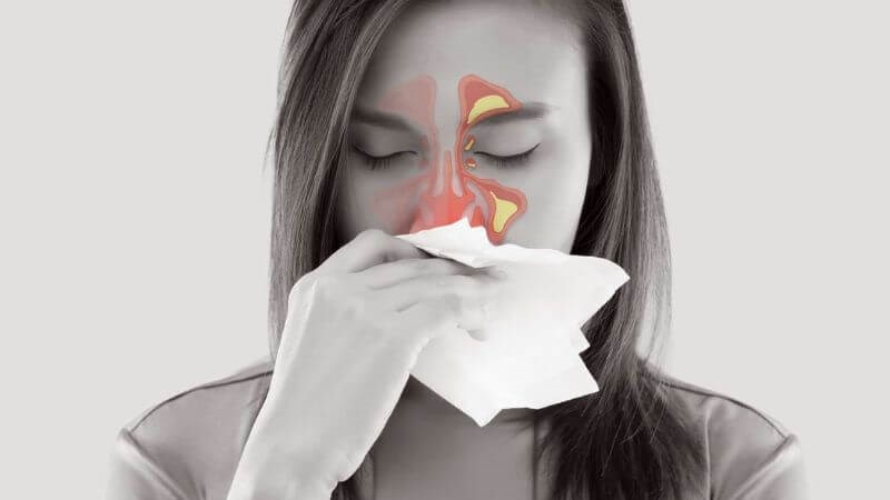 Viêm mũi xoang có thể gây mất khứu giác