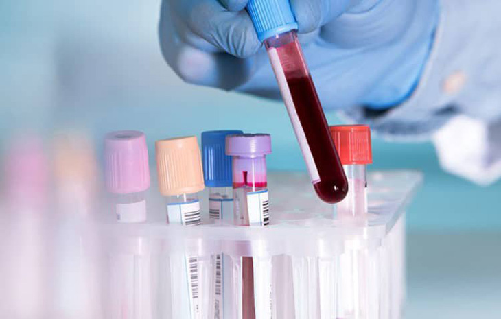 Xét nghiệm RPR và TPHA đều dùng mẫu máu để phân tích, nhưng chúng là 2 phương pháp xét nghiệm khác nhau