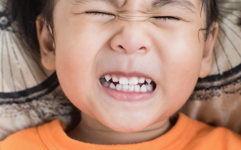 Chứng nghiến răng đêm ở trẻ em