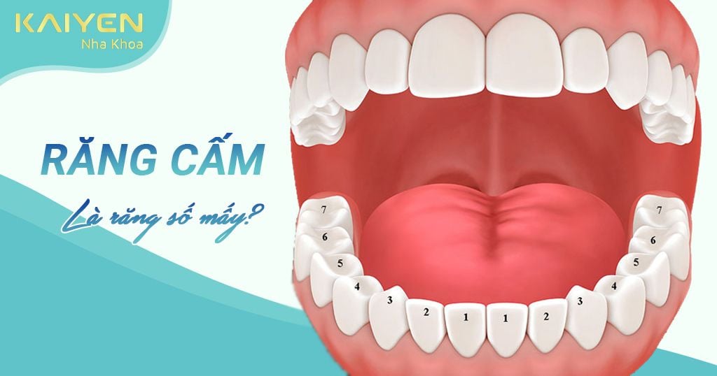 Răng cấm là răng gì? Có thay không? Những vấn đề thường gặp